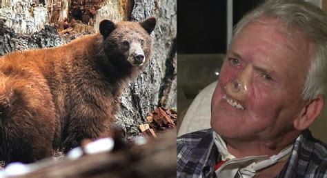 Hunter recovering after grizzly bear bites off part of his face